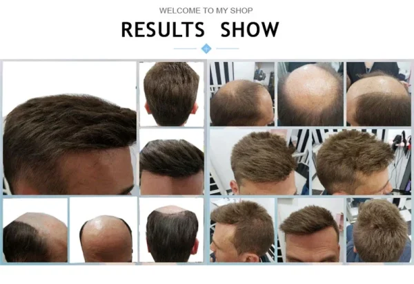 Pwigs1B80Thin Skin PU Bald Spot European Hair Patchesfor Crown Area Toupee For Men 8cm * 8cm Hair Piece Hair Replacement System - Image 17