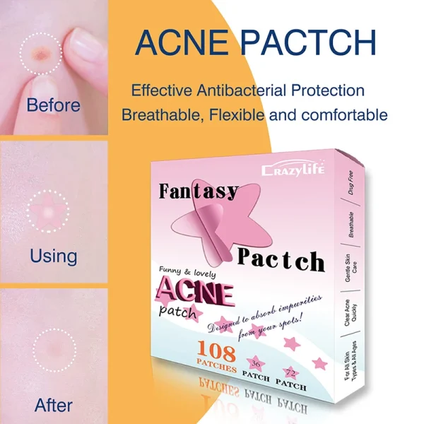 20-144patches /pack Invisible Acne Removal Pimple Patch Beauty Acne Tools Pimple Acne Concealer Face Spot Scar Care Stickers - Image 28