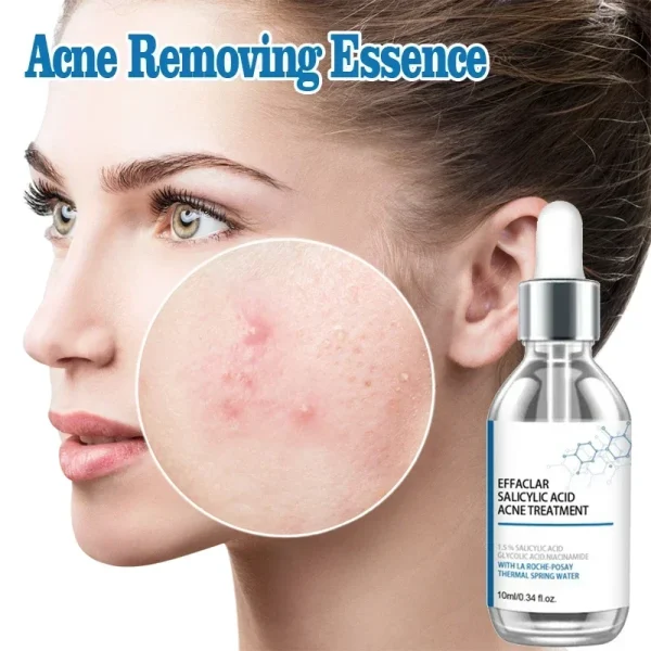 Salicylic Acid  Solution Essence Shrink pores and Acne Spot Removing Shrink Pores Oil-Control Brighten Face Skin Makeup - Image 2