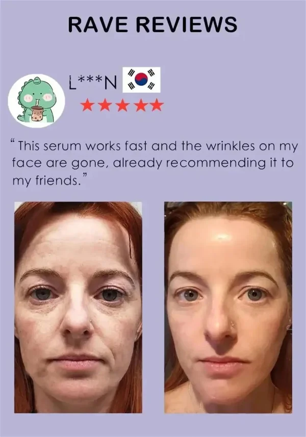 Retinol Wrinkle Remover Face Serum Instant Firming Lifting Anti-Aging Liquid Fade Fine Lines Whitening Korean Skin Care Products - Image 10